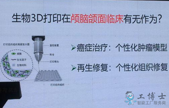 3D打印技术让医疗产业进入个性定制时代